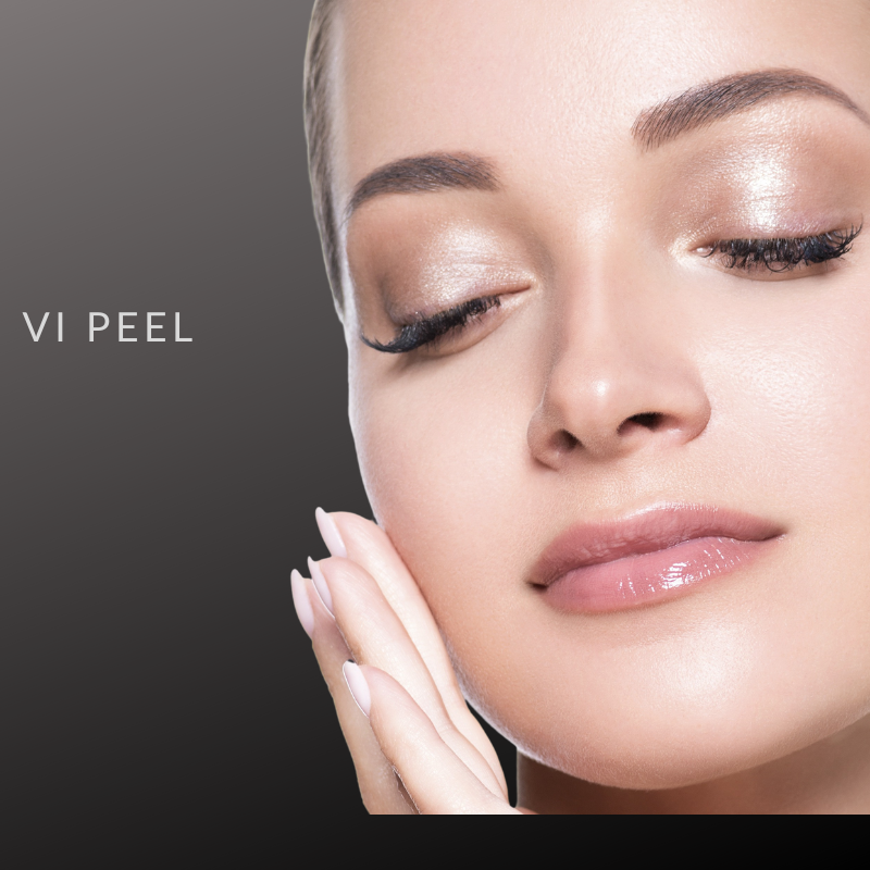 VI Peel