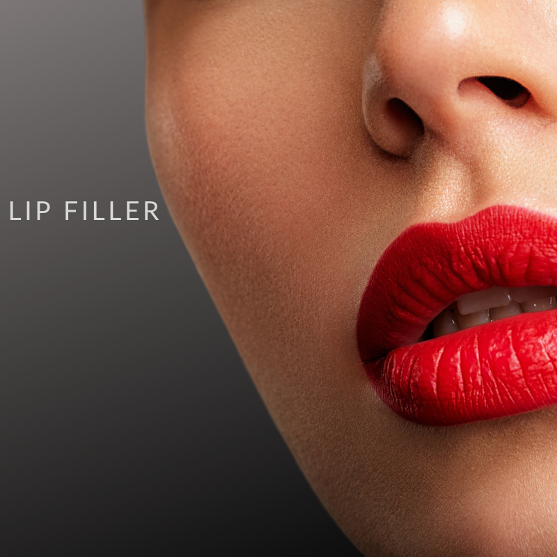 Lip Filler: 1 Syringe